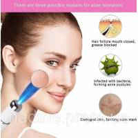 KD-7910 массажер для глаз Blu-ray acne pen